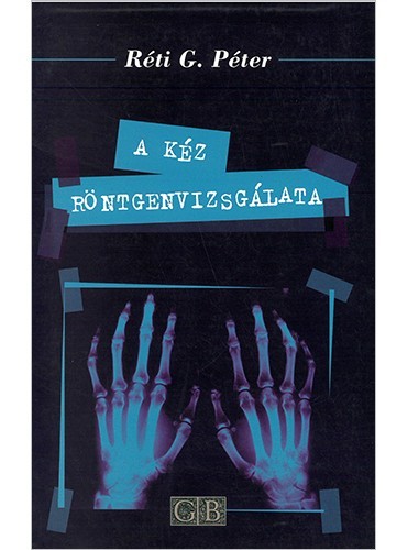 A kéz röntgenvizsgálata- Réti G. Péter